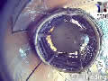 Le nid de rouge-queues en direct - via france-webcams.com